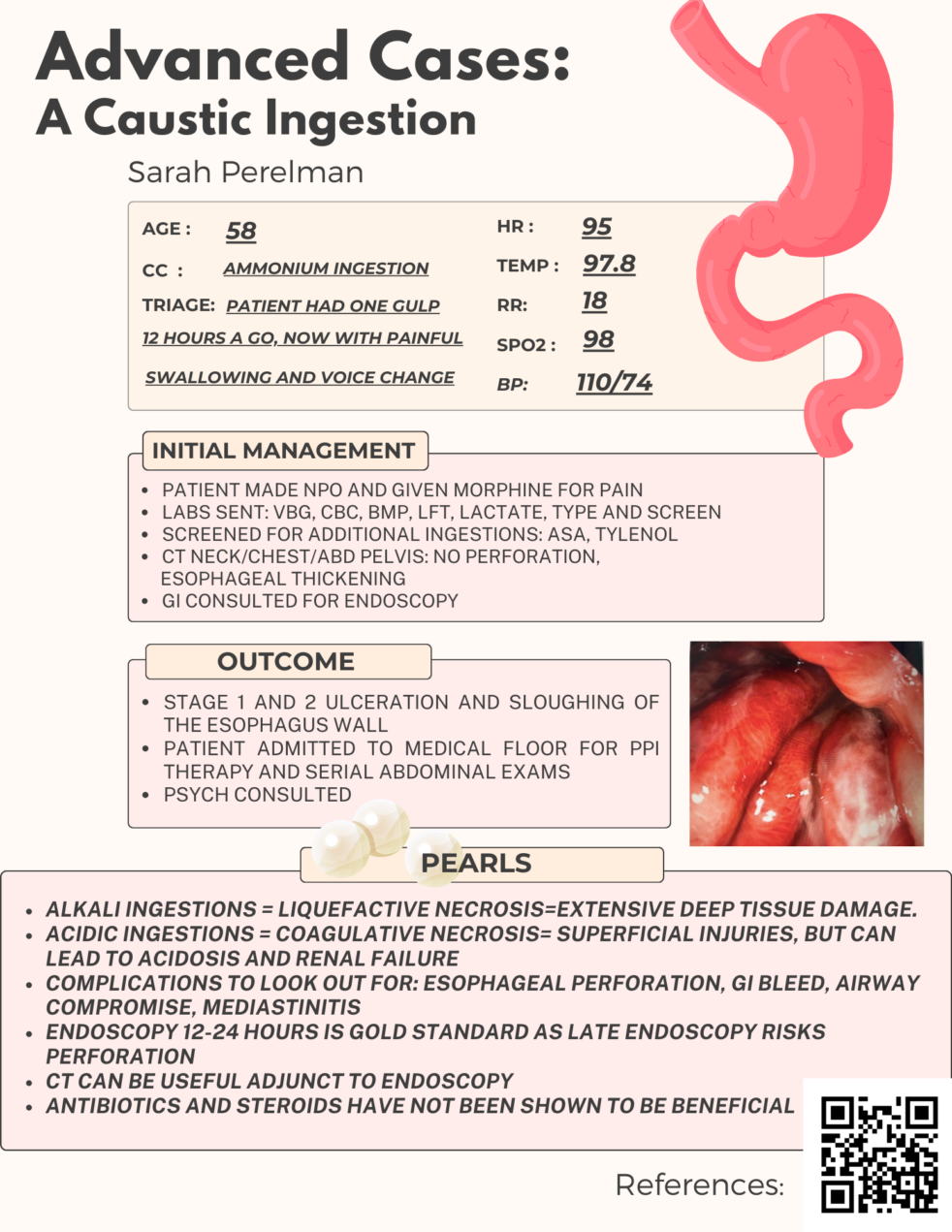 A Case of a Caustic Ingestion by Dr. Sarah, Perelman, PGY2 EM Daily
