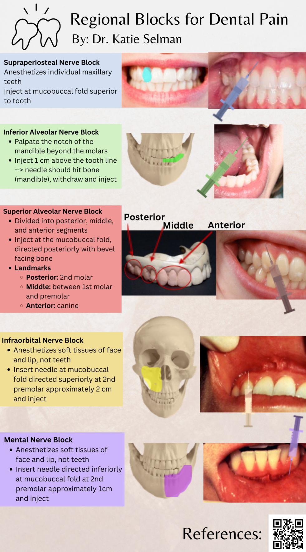 Regional blocks for Dental Pain, Dr. Katie Selman EM Daily